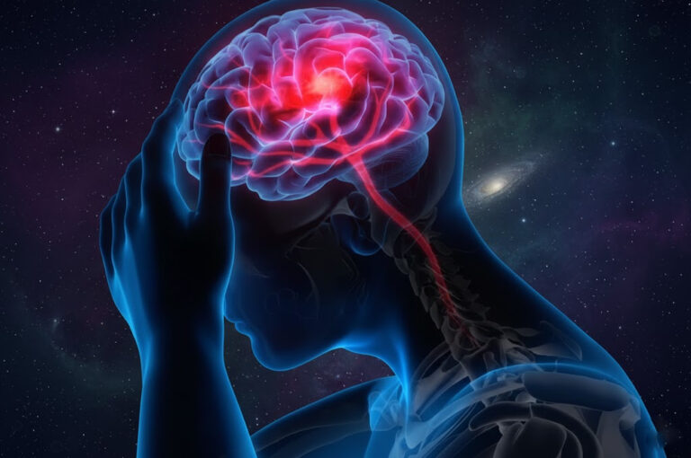 Stroke Symptoms FAST Rule – Illustration showing brain stroke highlighting affected brain area and blood flow disruption.