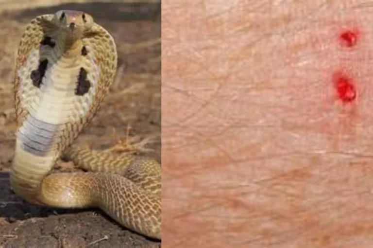 Snake Bite First Aid chart showing immobilization techniques and avoiding tourniquets.