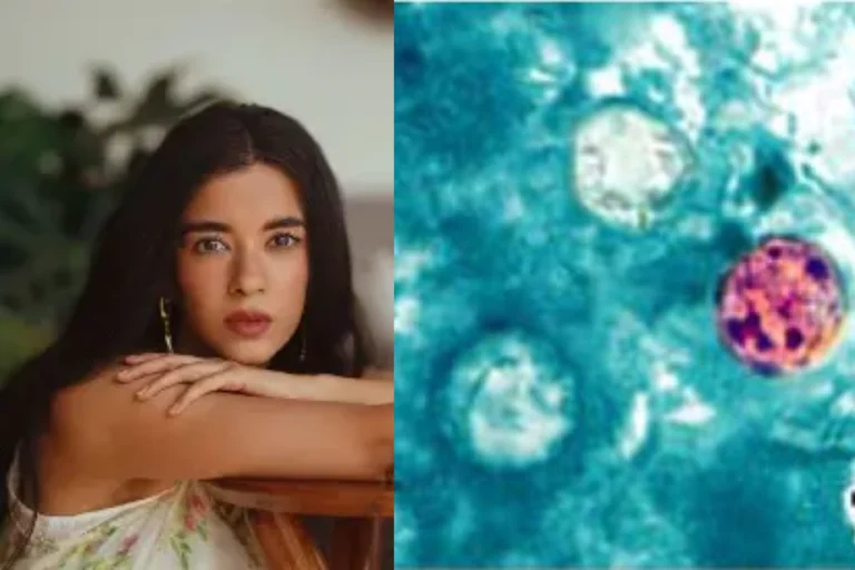 হঠাৎ অসুস্থ সাবা আজাদ! দ্রুত ওজন কমায় বাড়ছে উদ্বেগ, কোন অজানা রোগে ভুগছেন? সাবধান হোন আপনিও Cyclospora infection Saba Azad: Saba Azad suffering from Cyclospora infection while receiving medical care in hospital