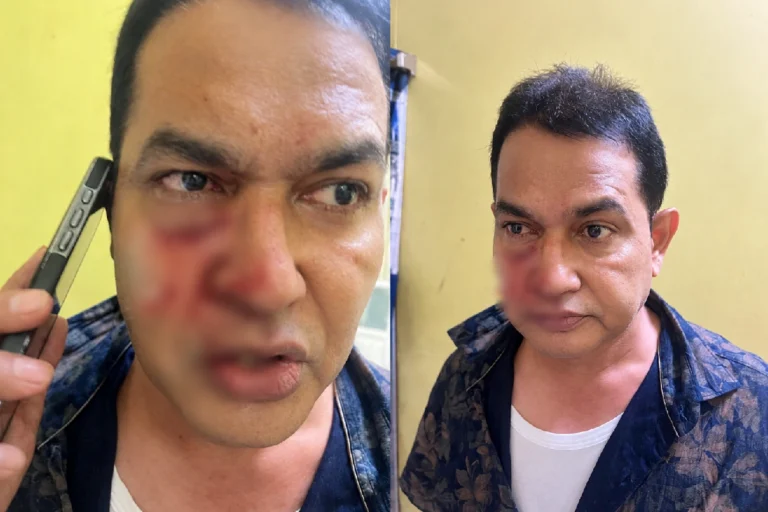 উপাসনাকে লক্ষ্য করে ডিম ছোড়ার অভিযোগ, রক্তাক্ত হুমায়ুন কবির, কী বলছে কালীঘাট তৃণমূল? Mukundapur TMC BJP Clash as Upasana Chowdhury faces protest outside East Jadavpur Police Station